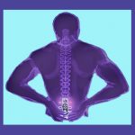 Arthritis in the Lumbar Spine - Lower Back Pain